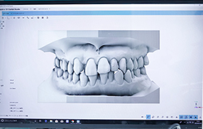 3D CADソフト